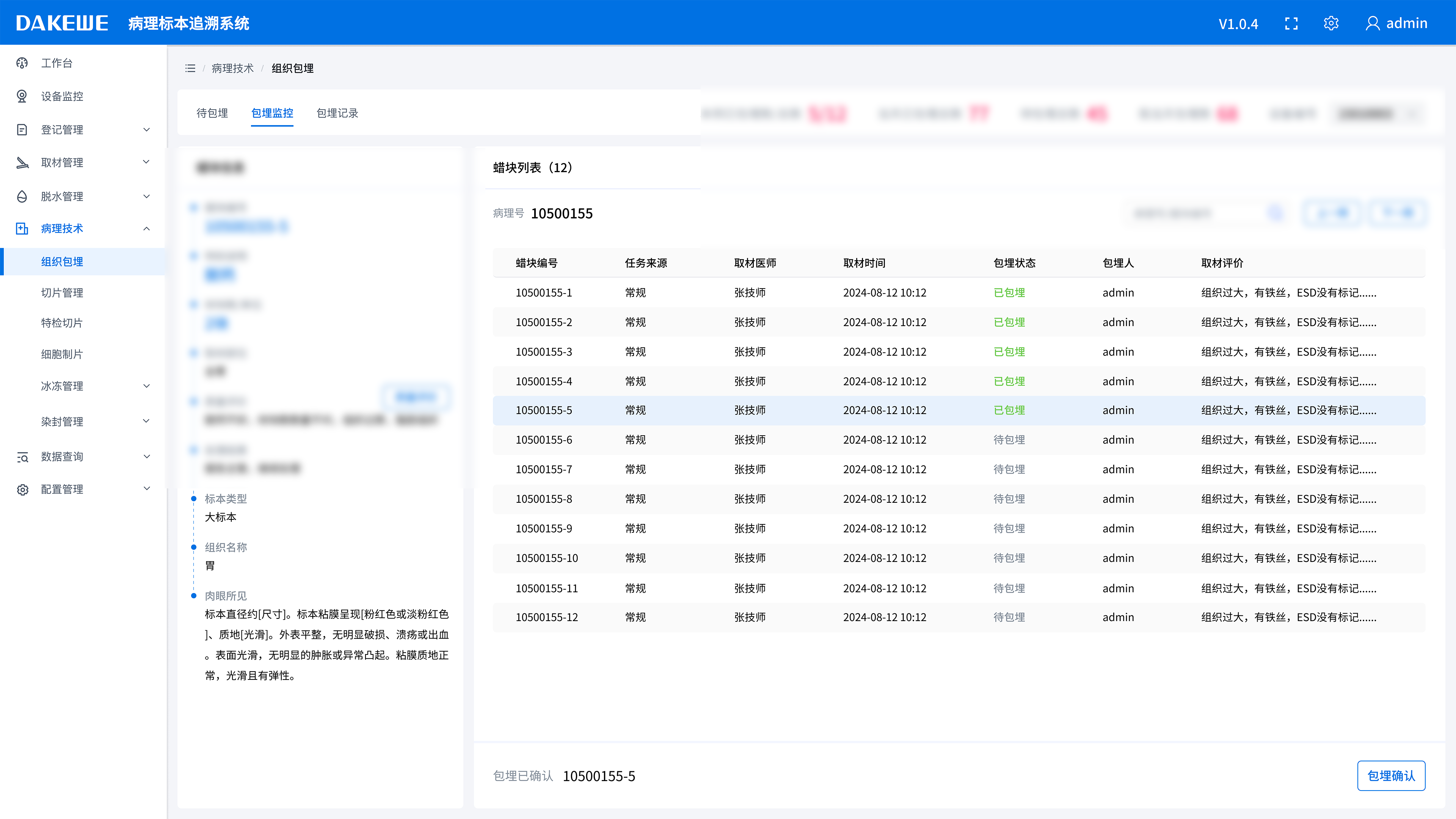 Block tracing